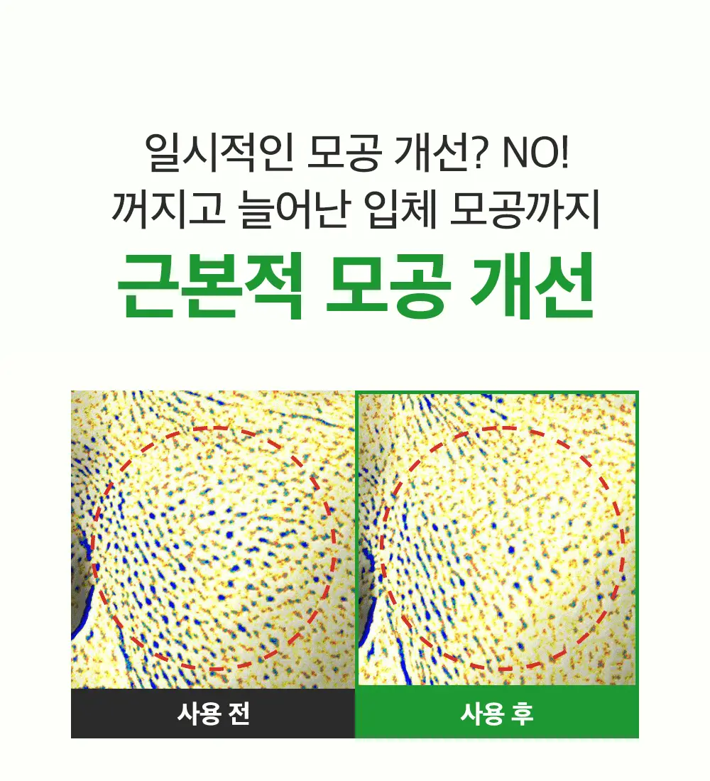 [포켓몬에디션/3D모공케어] 성분에디터 그린토마토 NMN 포어 리프팅 앰플 40ml 더블기획 (+키링 파우치)* 상세페이지 31